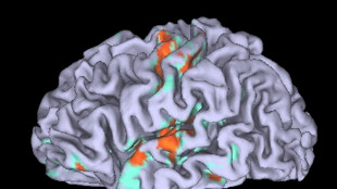 Cellule immunitarie proteggono il cervello dal Parkinson