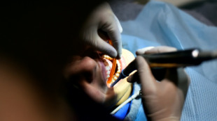 En Loz&egrave;re, un dentiste jug&eacute; pour des dizaines de mutilations