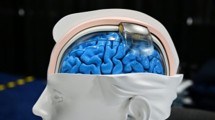 "Ya estamos en la ciencia ficción": la revolución de la neurotecnología