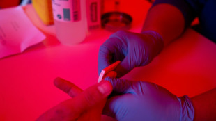 La précarité, un moteur de l'épidémie de VIH en Guyane 