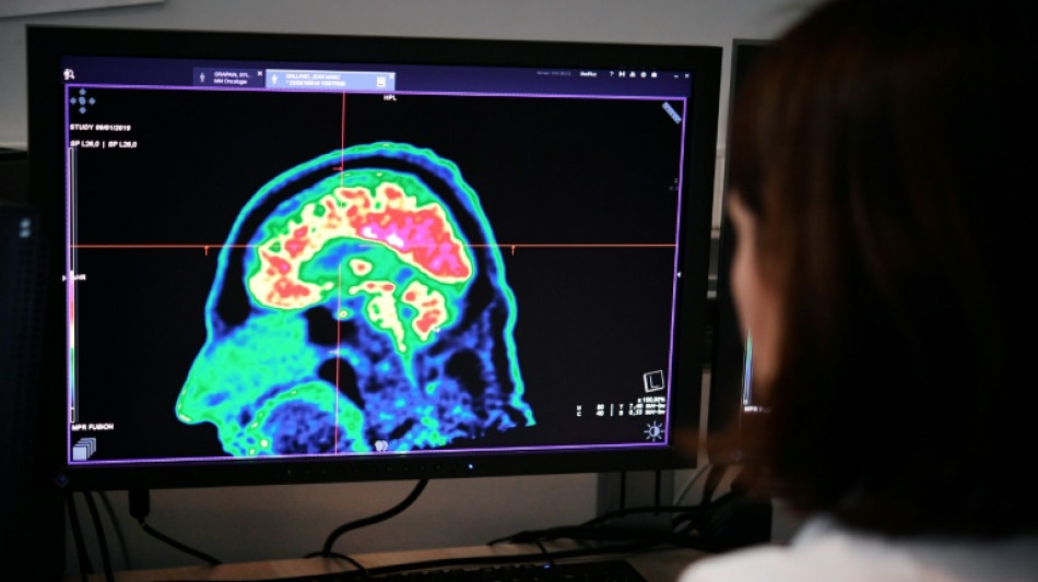 Un implante cerebral convierte los pensamientos en habla casi en tiempo real