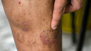 El "infierno" de los trabajadores v&iacute;ctimas de tr&aacute;fico en Camboya