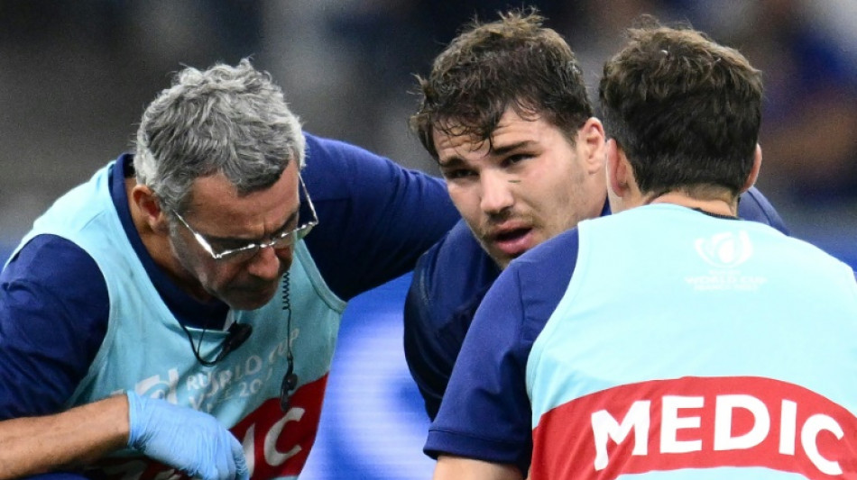 XV de France: Dupont souffre d'une fracture au niveau de la m&acirc;choire mais reste dans le groupe (f&eacute;d&eacute;ration)