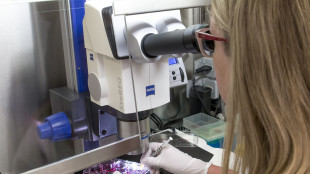 Infarto,cura con staminali riduce rischio insufficienza cardiaca